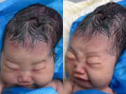 Yêu con - Bé gái sơ sinh chào đời với cái đầu nhọn, bố sợ hãi không nhận con, bác sĩ báo tin vui