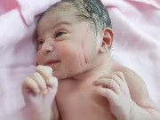 Bà bầu - Vừa rời phòng đẻ phát hiện nhiều vết thương trên mặt con sơ sinh, gia đình nghi ngờ bác sĩ tắc trách, đòi kiện