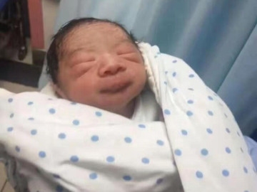 Bé sơ sinh chào đời da nhăn nheo như khỉ con, nửa năm sau bố mẹ kinh ngạc không nhận ra đứa trẻ ngày nào