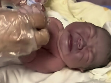 Bà bầu - Bà bầu muốn con trắng trẻo nên ngày nào cũng ăn một thứ, phát hoảng khi đứa trẻ chào đời da tím sẫm, nặng 4kg