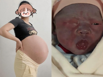 Bà bầu - Bà bầu mang thai 33 tuần bị đau lưng, bác sĩ hoảng hốt khám: "Phẫu thuật ngay, nếu không cả mẹ và con đều khó sống"