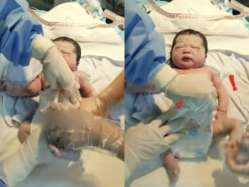 Yêu con - Bé sơ sinh chào đời bị bác sĩ và y tá liên tục tác động ngay trên bàn mổ, người mẹ rối rít cảm ơn