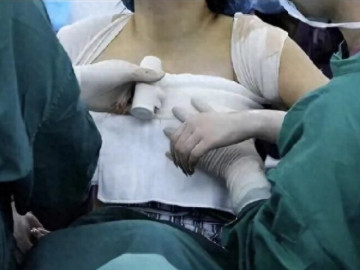 Yêu con - Mẹ phát hiện trên áo ngực con gái 13 tuổi thường xuyên dính màu lạ, đưa đi khám nghe bác sĩ nói mà run rẩy