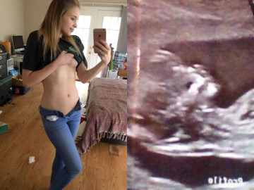 Bà bầu - Nữ sinh chụp bụng bầu 7 tháng phẳng lỳ, láng mịn, ảnh siêu âm đứa trẻ khiến nhiều người hoang mang