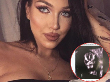 Mẹ bầu khoe ảnh siêu âm của con lên mạng, nhiều người nhìn thấy liền khuyên em bé "có vấn đề" và cái kết