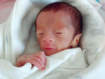 Con chào đời mặt teo hóp trông như quả mận, người mẹ buồn lòng, không ngờ giờ đứa trẻ lột xác khó tin