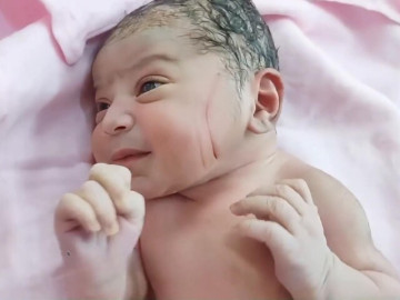 Bà bầu - Vừa rời phòng đẻ phát hiện nhiều vết thương trên mặt con sơ sinh, gia đình nghi ngờ bác sĩ tắc trách, đòi kiện