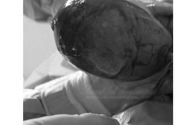 Bức ảnh được chụp bởi nhiếp ảnh gia Ashley Renee về khuôn mặt em bé khi mà màng ối vẫn chưa được xé rách.
