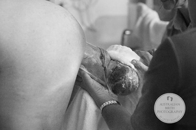 'Rất hiếm gặp được khoảnh khắc bé sinh ra còn nguyên trong bọc ối vì vậy hình ảnh này đâu có gì đáng sợ.', nhiếp ảnh gia Lacey Barratt ghi chú thích về bức ảnh này.
