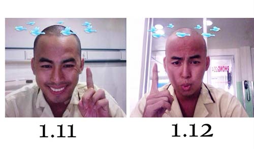 Duy Nhân lạc quan sau 1 tháng cách ly chữa ung thư - 1