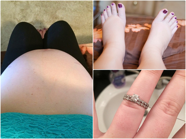 Ở tuần 32 thai kỳ, bụng bầu của mẹ Brittany Yankowski đã khá lớn và chân tay đã sưng phù lên. Chiếc nhẫn cưới cô đã không thể đeo vừa.
