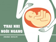 Bà bầu - Những vị trí nằm “oái oăm” của thai nhi trong bụng mẹ