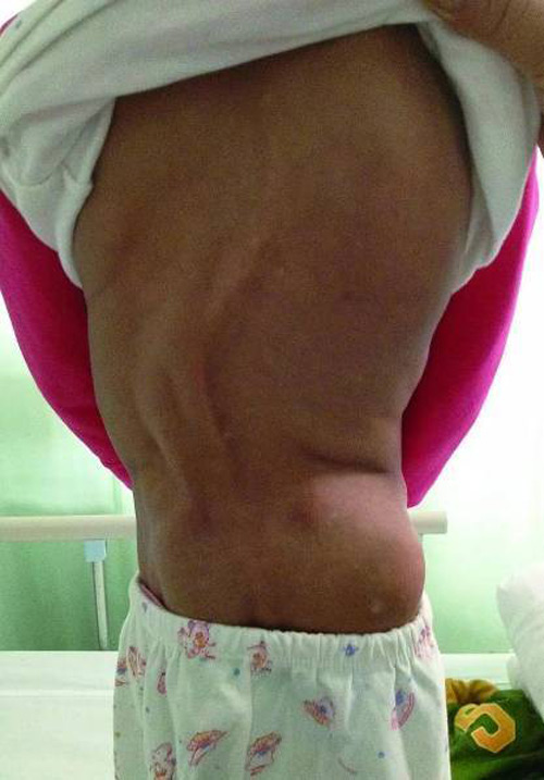 Mắc hội chứng hiếm gặp, cô bé 11 tuổi phải sống trong ngoại hình của cụ bà 80 - 2