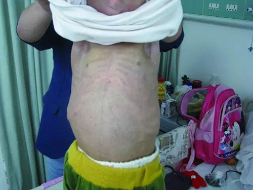 Mắc hội chứng hiếm gặp, cô bé 11 tuổi phải sống trong ngoại hình của cụ bà 80 - 1