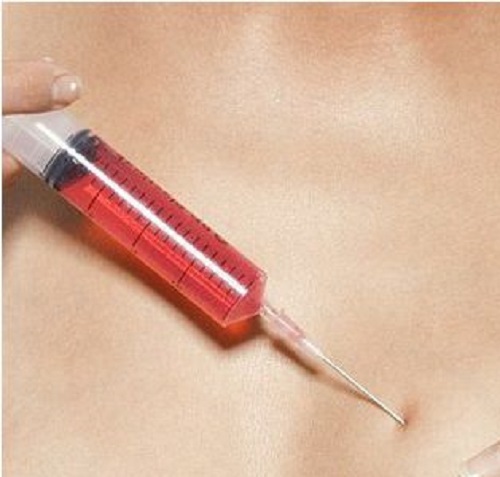 Ngày mai xử vụ thuê người tiêm máu có HIV vào con tình địch - 1