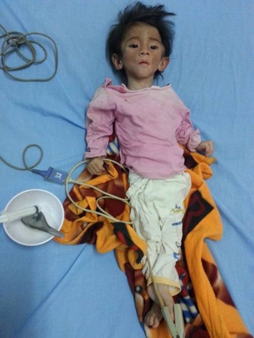 Bé gái Sa Pa da bọc xương giờ amp;#39;xinh đẹp như công chúaamp;#39; - 3