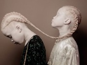 Thời trang - Mang căn bệnh hiếm gặp nhưng cặp chị em sinh đôi này vẫn là mẫu nhí siêu hot