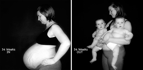 “Rõ mồn một” cuộc sống chen chúc của cặp song thai trong bụng mẹ - 12