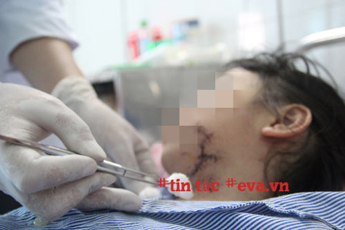 Vụ cha chém con 5 tuổi tử vong: Mẹ cố đỡ từng nhát dao để cứu hai con mà không thể - 2