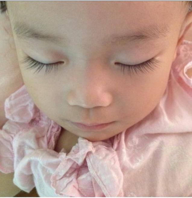 Người mẹ sốc nặng khi biết nguyên nhân mắt con nhỏ sưng húp, chảy mủ - 3