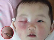 Làm mẹ - Người mẹ sốc nặng khi biết nguyên nhân mắt con nhỏ sưng húp, chảy mủ
