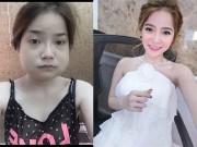 Làm đẹp - Chi bạo tiền thẩm mỹ, nhan sắc trước và sau của cô gái 9x khiến ai cũng phải choáng