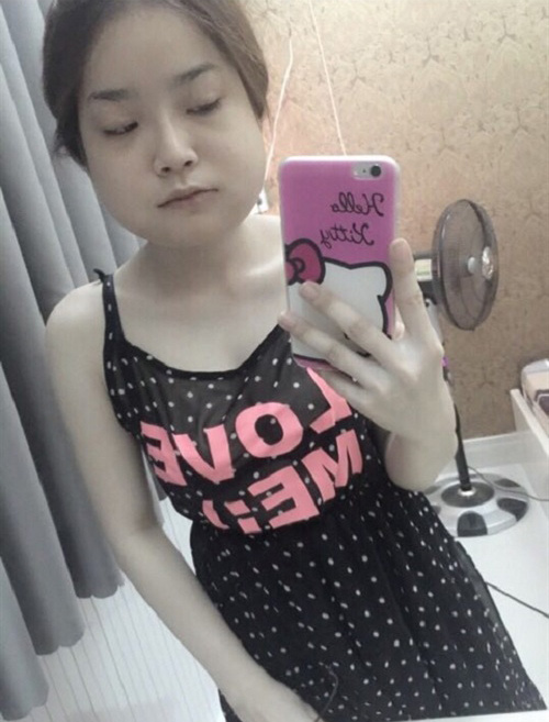 Chi bạo tiền thẩm mỹ, nhan sắc trước và sau của cô gái 9x khiến ai cũng phải choáng - 5