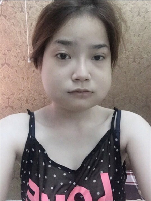 Chi bạo tiền thẩm mỹ, nhan sắc trước và sau của cô gái 9x khiến ai cũng phải choáng - 3