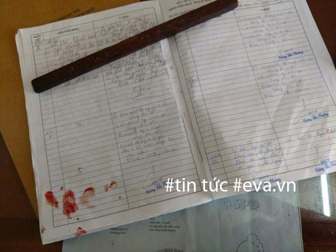 Hà Nội: Bác sĩ bị người nhà bệnh nhân đánh bất tỉnh, chấn thương sọ não - 2