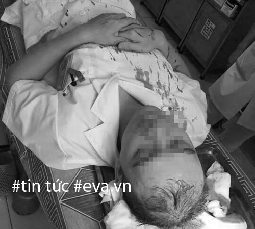 Hà Nội: Bác sĩ bị người nhà bệnh nhân đánh bất tỉnh, chấn thương sọ não - 1