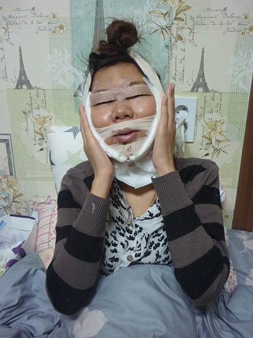Cô gái 9x Hà Nội khiến ai cũng ngỡ ngàng vì diện mạo xinh đẹp sau thẩm mỹ - 6