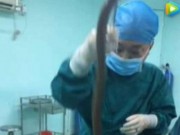 Tin tức - Nhét con lươn dài nửa mét vào hậu môn chữa táo bón, người đàn ông suýt bỏ mạng
