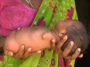 Làm mẹ - Nỗi lòng người mẹ sinh ra bé không tay chân được ví như "phiên bản" Nick Vujicic