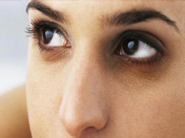 Quầng thâm ở mắt rất có thể là dấu hiệu bệnh gan, thận