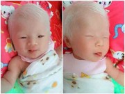 Làm mẹ - Sinh con da trắng như "trứng gà bóc", mẹ đau lòng khi phát hiện ra sự thật