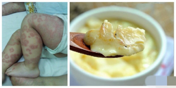 Thấy cháu há miệng nên bà cho ăn vài thìa trứng, ít phút sau phải nhập viện khẩn cấp - 4