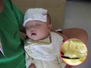 Làm mẹ - Thấy cháu há miệng nên bà cho ăn vài thìa trứng, ít phút sau phải nhập viện khẩn cấp