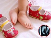 Làm mẹ - Mua giày rộng cho con đi để đỡ tốn tiền, mẹ chẳng thể ngờ chân con thành thế này