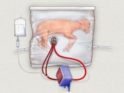 Tin tức - Nghiên cứu mới gây sốt: Trẻ sinh non có thể sống sót bên ngoài tử cung của mẹ