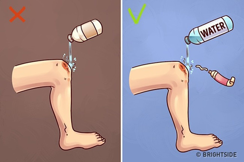 Nhấn vào ảnh để phóng to tu so cuu vet thuong tai nha don gian nhung nhieu nguoi sai lam, ruoc hoa vao than - 1