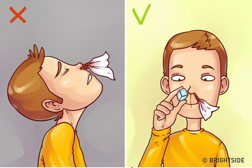 Nhấn vào ảnh để phóng to tu so cuu vet thuong tai nha don gian nhung nhieu nguoi sai lam, ruoc hoa vao than - 3