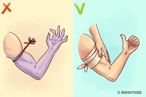 Nhấn vào ảnh để phóng to tu so cuu vet thuong tai nha don gian nhung nhieu nguoi sai lam, ruoc hoa vao than - 6