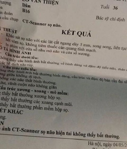 Lời kể của công nhân thoát chết trong vụ sập giàn giáo chung cư ở Hà Đông - 2