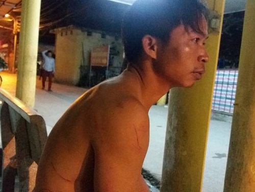 Lời kể của công nhân thoát chết trong vụ sập giàn giáo chung cư ở Hà Đông - 1