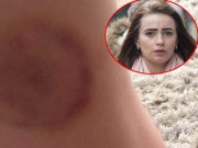 Tin tức - Bé gái 4 tuổi cắn em trai, bà mẹ trẻ dạy con một bài học rồi nổi tiếng khắp thế giới