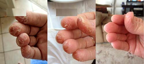 Cứ chạm vào dầu rửa bát là bong da tay hãy áp dụng ngay mẹo này để cải thiện nhé - 5