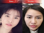 Làm đẹp - Quế Vân công khai chi tiết quá trình phẫu thuật thẩm mỹ đau đớn rợn người