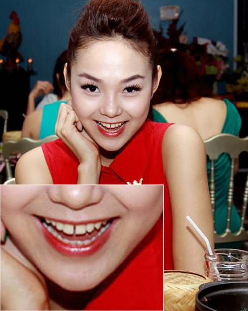 Thì ra Minh Hằng đã âm thầm phẫu thuật bộ phận “kém duyên” để đẹp không tì vết - 3