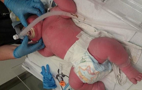 Sau 3 giờ nỗ lực đẻ thường thất bại, bố mẹ ‘sốc nặng’ khi mổ đẻ ra con thế này - 1