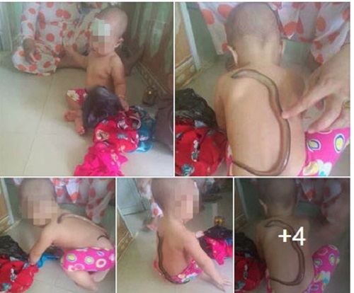 “Hại đơn, hại kép” vì sai lầm của các mẹ khi hạ sốt cho con - 3